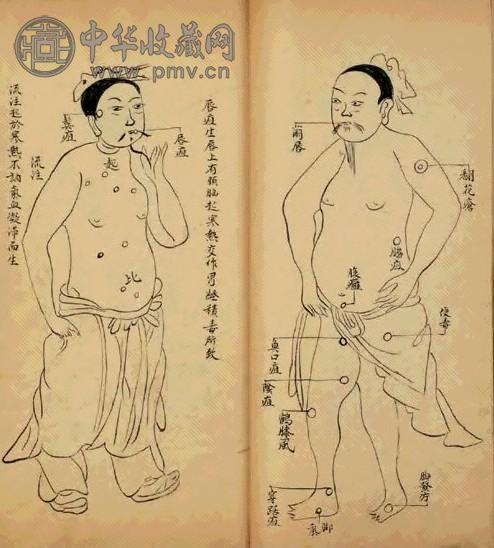 清 新刊外科正宗