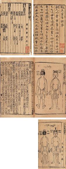 太监王公编 针灸资生经七卷